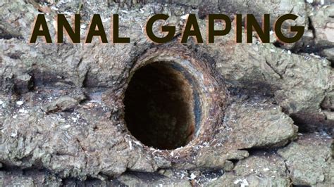 Anal Gaping Porn Videos .